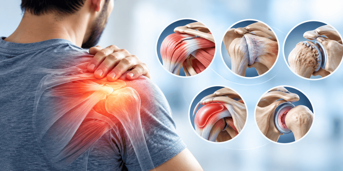 Shoulder pain illustration showing a man holding his painful shoulder with highlighted shoulder anatomy and common conditions including rotator cuff injury, frozen shoulder, arthritis, bursitis and joint instability.